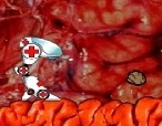 Robot-medicale